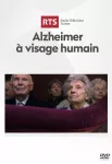 Alzheimer à visage humain.